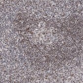 Anti-IRF2 antibody produced in rabbit Prestige Antibodies® Powered by Atlas Antibodies, affinity isolated antibody, buffered aqueous glycerol solution