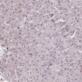 Anti-PRDM5 antibody produced in rabbit Prestige Antibodies® Powered by Atlas Antibodies, affinity isolated antibody, buffered aqueous glycerol solution