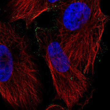 Anti-Plpp2 Antibody Produced In Rabbit Prestige Antibodies® Powered by Atlas Antibodies, affinity isolated antibody, buffered aqueous glycerol solution