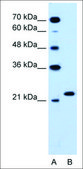Anti-RAB14 antibody produced in rabbit affinity isolated antibody