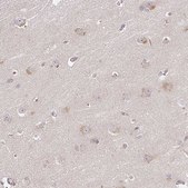 Anti-DIMT1 antibody produced in rabbit Prestige Antibodies® Powered by Atlas Antibodies, affinity isolated antibody, buffered aqueous glycerol solution