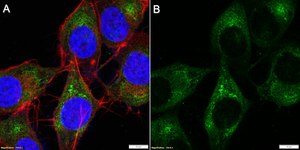 Anti-Integrin α2 Antibody, clone 1E17 ZooMAb® Rabbit Monoclonal recombinant, expressed in HEK 293 cells