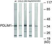 Anti-PDLIM1 antibody produced in rabbit affinity isolated antibody