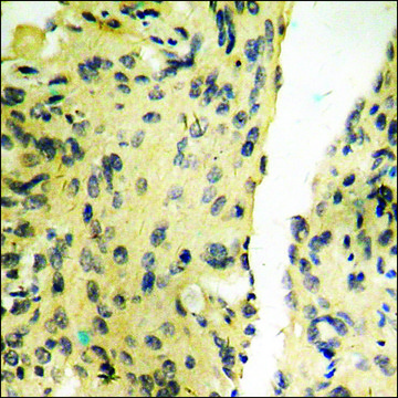 Anti-phospho-Tyrosine Hydroxylase (pSer40) antibody produced in rabbit affinity isolated antibody