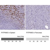 Anti-PITPNM3 antibody produced in rabbit Prestige Antibodies® Powered by Atlas Antibodies, affinity isolated antibody, buffered aqueous glycerol solution