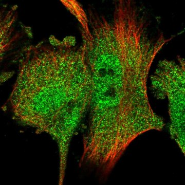 Anti-RACK1 antibody produced in rabbit affinity isolated antibody, buffered aqueous glycerol solution