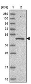 Anti-C19orf47 antibody produced in rabbit Prestige Antibodies® Powered by Atlas Antibodies, affinity isolated antibody, buffered aqueous glycerol solution