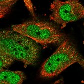 Anti-ATF5 antibody produced in rabbit Prestige Antibodies® Powered by Atlas Antibodies, affinity isolated antibody, buffered aqueous glycerol solution