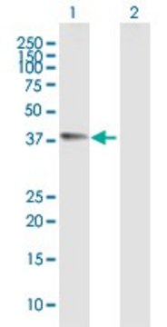 Anti-CHI3L1 antibody produced in mouse purified immunoglobulin, buffered aqueous solution