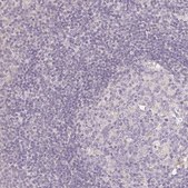 Anti-SEZ6L2 antibody produced in rabbit Prestige Antibodies® Powered by Atlas Antibodies, affinity isolated antibody, buffered aqueous glycerol solution