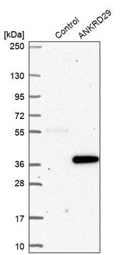 Anti-ANKRD29 antibody produced in rabbit Prestige Antibodies&#174; Powered by Atlas Antibodies, affinity isolated antibody, buffered aqueous glycerol solution