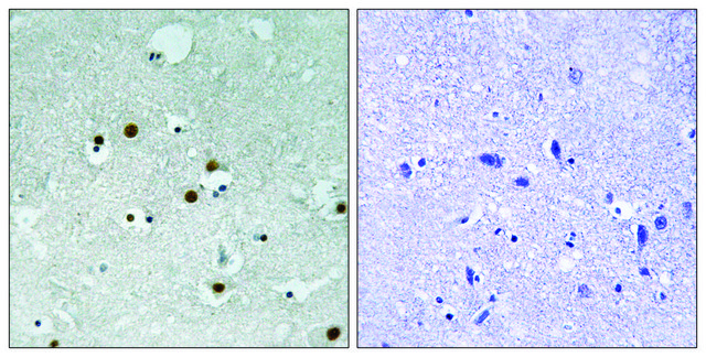 Anti-HP1 &#945; antibody produced in rabbit affinity isolated antibody