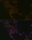 Anti-SMURF2 antibody produced in rabbit