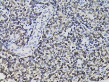Anti-TMPO antibody produced in rabbit