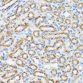 Anti-NDUFS4 antibody produced in rabbit