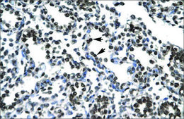 Anti-PTHLH antibody produced in rabbit IgG fraction of antiserum