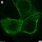 Anti-CFTR Antibody, clone MM13-4 ZooMAb® Mouse Monoclonal recombinant, expressed in HEK 293 cells