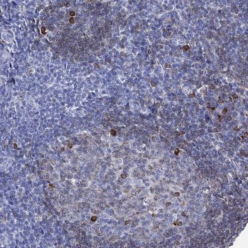 Anti-Cd79A Antibody Produced In Rabbit Prestige Antibodies® Powered by Atlas Antibodies, affinity isolated antibody, buffered aqueous glycerol solution
