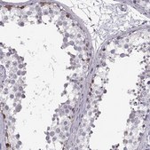 Anti-NANOS3 antibody produced in rabbit Prestige Antibodies® Powered by Atlas Antibodies, affinity isolated antibody, buffered aqueous glycerol solution