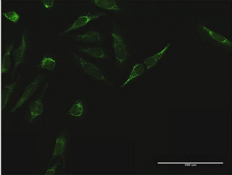 Anti-TIMM44 antibody produced in mouse purified immunoglobulin, buffered aqueous solution