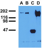 Monoclonal Anti-EGFR (PhosphoTyr992) antibody produced in mouse clone EM-12