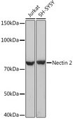 Anti-Nectin 2/CD112 Antibody, clone 3H0G2, Rabbit Monoclonal