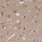 Anti-SRGAP3 antibody produced in rabbit Prestige Antibodies® Powered by Atlas Antibodies, affinity isolated antibody, buffered aqueous glycerol solution