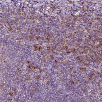 Anti-SEMA4A antibody produced in rabbit Prestige Antibodies&#174; Powered by Atlas Antibodies, affinity isolated antibody, buffered aqueous glycerol solution