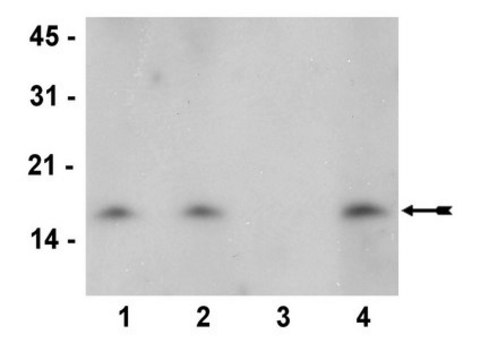 Anti-dimethyl-Histone H3 (Lys27) Antibody, clone 614M, rabbit monoclonal culture supernatant, clone 614M, from rabbit