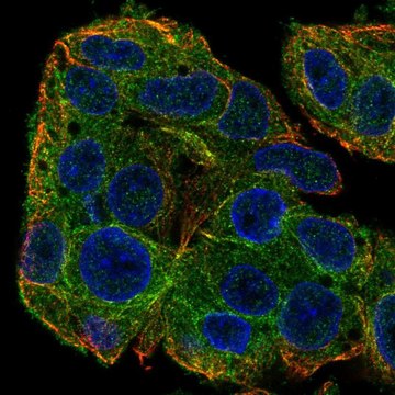 Anti-SLC38A3 antibody produced in rabbit Prestige Antibodies&#174; Powered by Atlas Antibodies, affinity isolated antibody