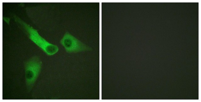 Anti-CASP9 antibody produced in rabbit affinity isolated antibody