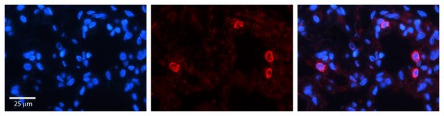 Anti-NFATC4 (AB2) antibody produced in rabbit affinity isolated antibody