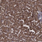 Anti-ACOT13 antibody produced in rabbit Prestige Antibodies® Powered by Atlas Antibodies, affinity isolated antibody, buffered aqueous glycerol solution