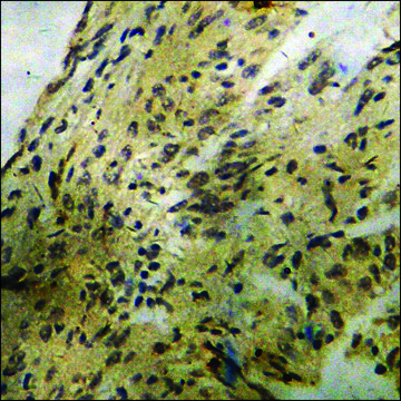 Anti-phospho-BCL-2 (pSer70) antibody produced in rabbit affinity isolated antibody