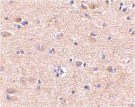 Anti-VGF Antibody from rabbit, purified by affinity chromatography