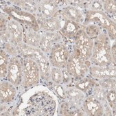 Anti-HCN3 antibody produced in rabbit Prestige Antibodies® Powered by Atlas Antibodies, affinity isolated antibody, buffered aqueous glycerol solution