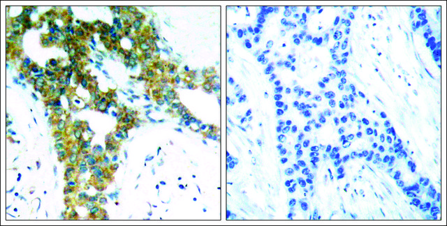 Anti-PAK1/PAK2/PAK3 (Ab-423/402/421) antibody produced in rabbit affinity isolated antibody