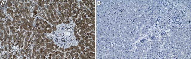 Anti-MAP3K8 Antibody, clone 1D11 ZooMAb&#174; Rabbit Monoclonal recombinant, expressed in HEK 293 cells