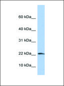 Anti-IL1B antibody produced in rabbit affinity isolated antibody