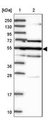 Anti-GAL3ST4 antibody produced in rabbit Prestige Antibodies® Powered by Atlas Antibodies, affinity isolated antibody, buffered aqueous glycerol solution
