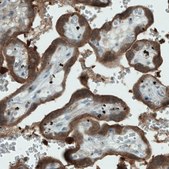 Monoclonal Anti-NAPRT antibody produced in mouse Prestige Antibodies® Powered by Atlas Antibodies, clone CL0665, purified immunoglobulin, buffered aqueous glycerol solution