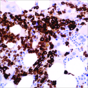 Myeloperoxidase (EP151) Rabbit Monoclonal Primary Antibody