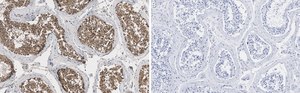 Anti-EZHIP/CXorf67 Antibody, clone 1J8 ZooMAb® Rabbit Monoclonal recombinant, expressed in HEK 293 cells