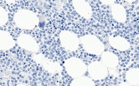 Anti-p38α/SAPK2A Antibody, clone 1O11 ZooMAb® Rabbit Monoclonal recombinant, expressed in HEK 293 cells