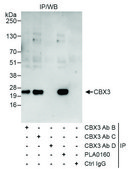 Rabbit anti-CBX3 Antibody, Affinity Purified Powered by Bethyl Laboratories, Inc.