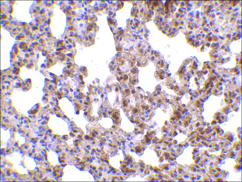 Anti-TRPC6 (ab1) antibody produced in rabbit affinity isolated antibody, buffered aqueous solution