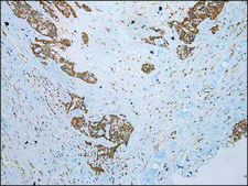 Anti-CCBL1 affinity isolated antibody