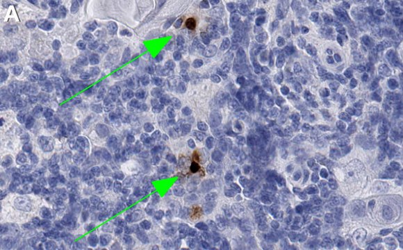 Anti-CXCL10 Antibody, clone 3F14 ZooMAb&#174; Rabbit Monoclonal recombinant, expressed in HEK 293 cells