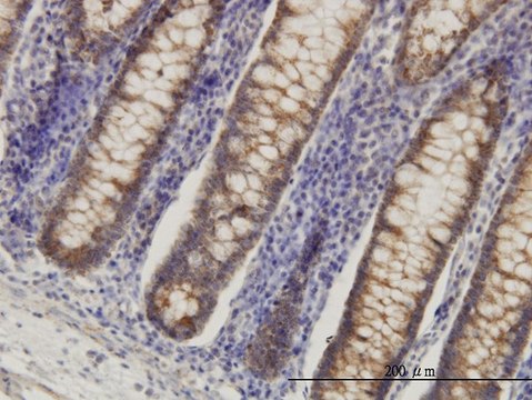 Monoclonal Anti-HADHSC antibody produced in mouse clone 4B5, purified immunoglobulin, buffered aqueous solution