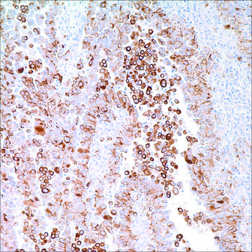 Cytokeratin 5 &amp; 6 (D5 &amp; 16B4) Mouse Monoclonal Antibody